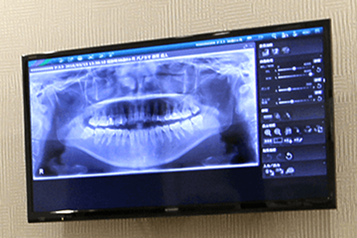  歯科用CTを導入しており、精密な検査が可能です